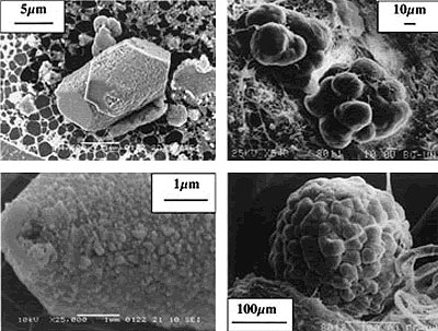 Penial Gland Calcite Microcrystals